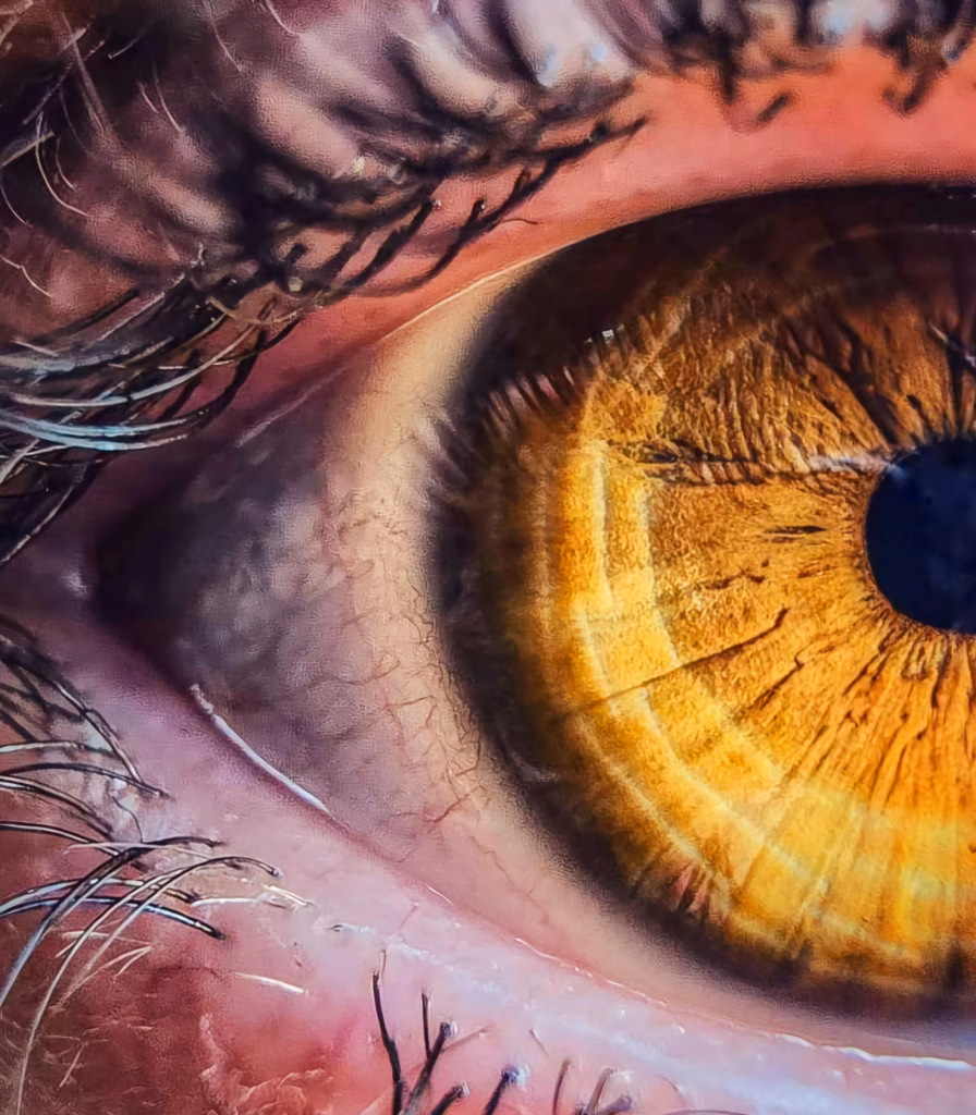 EMDR for Complex PTSD or CPTST EMDR for Complex PTSD or CPTST